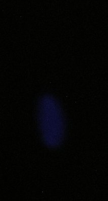 ZnS(Ag) @ 50 keV X-ray as  taken