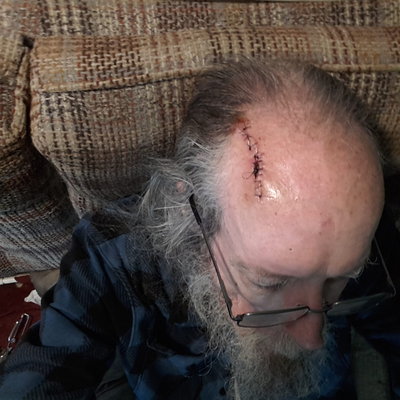 Now it only feels like being hit with a baseball bat last week instead of 5 min ago.  Whew.